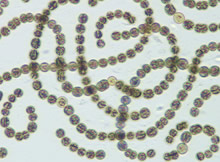 Anabaena