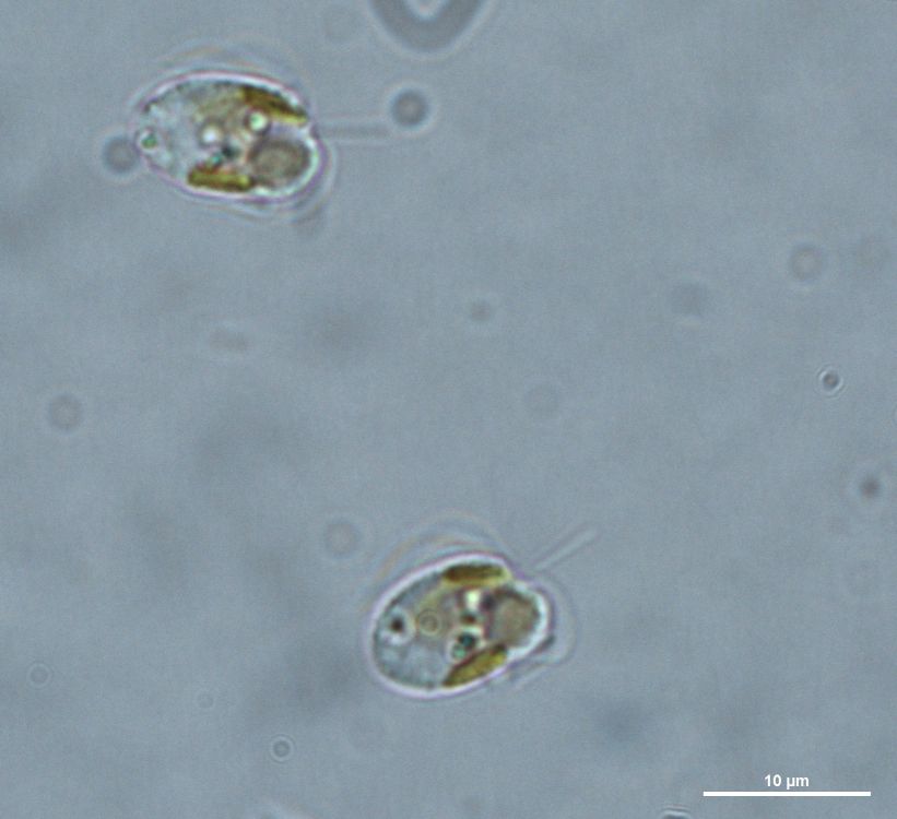 Prymnesium parvum; Foto: K. Preuß, IGB