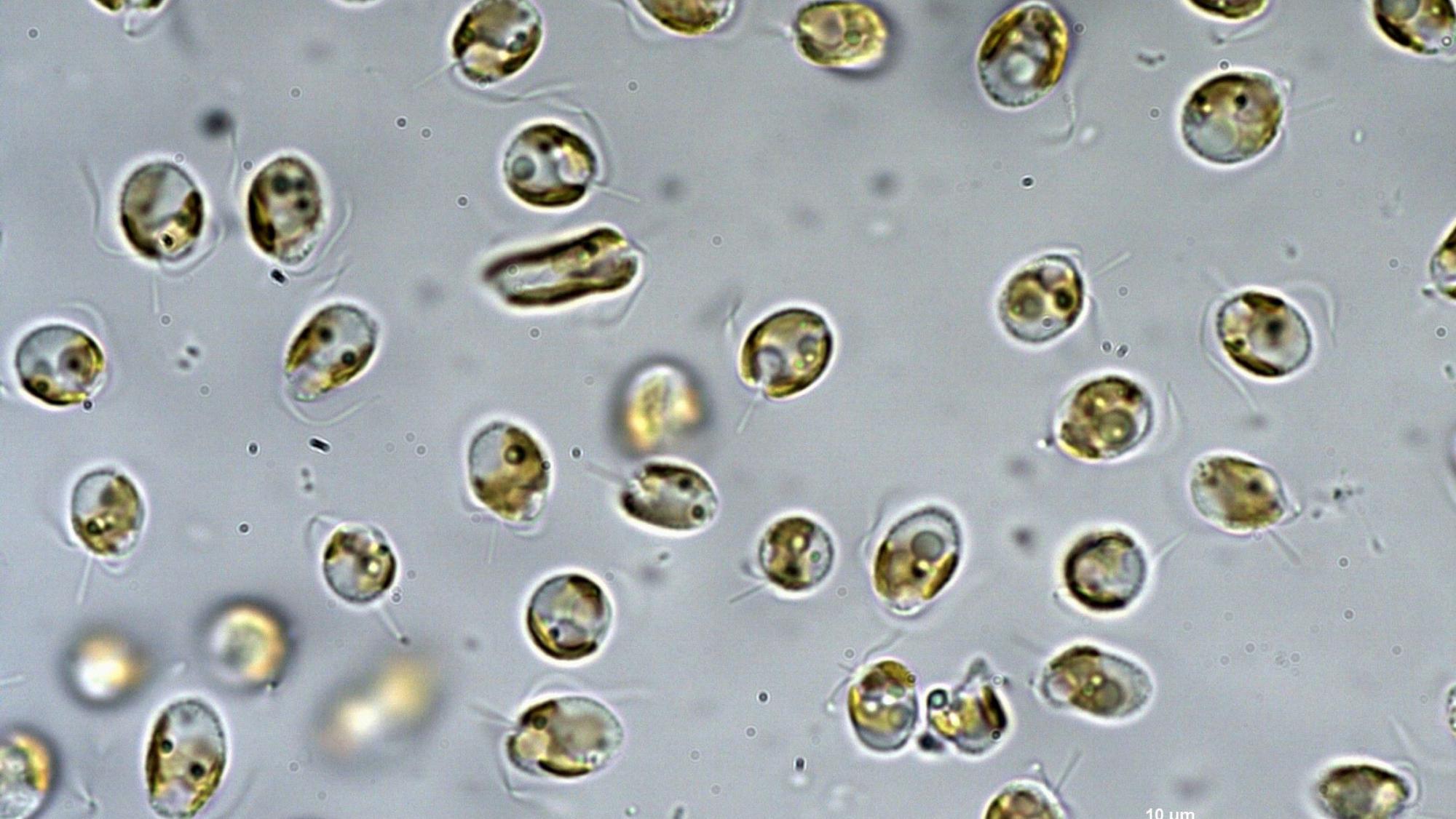 Die Giftalge Prymnesium parvum unter dem Mikroskop.