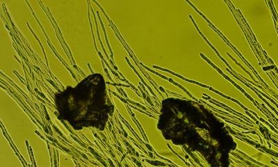 fungal strain under the microscope