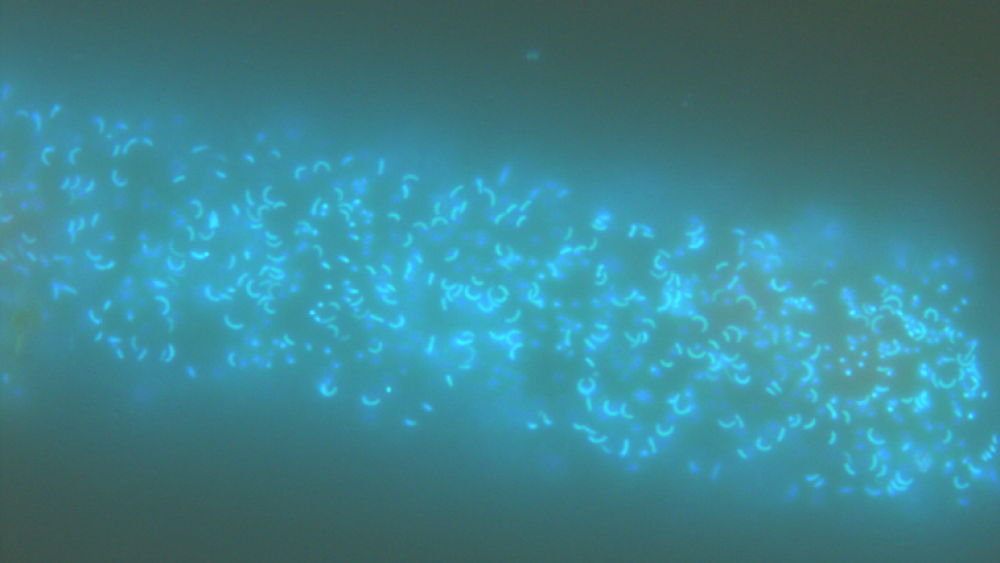 Phytoplankton-Bacteria Interactions, Dolichospermum spec. from Lake Stechlin colonized by heterotrophic bacteria (DAPI staining, 1000x epifluorescence microscopy). | Bild: Hans-Peter Grossart / IGB