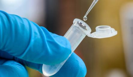 Pipetting of a sample by a scientist
