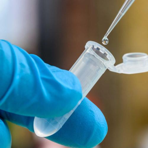 Pipetting of a sample by a scientist