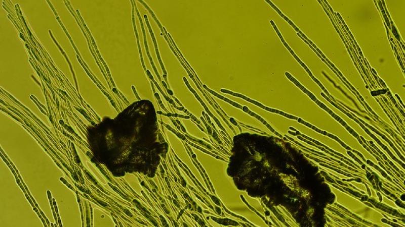 fungal strain under the microscope